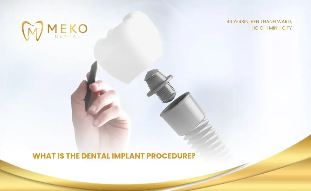 What is the dental implant procedure?