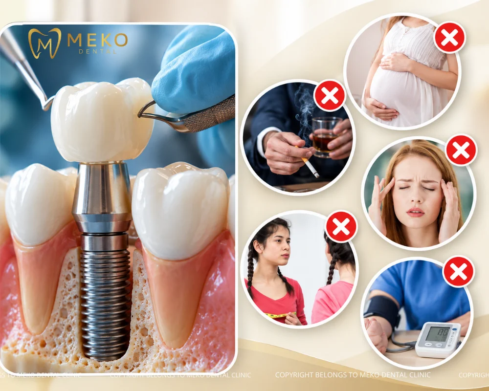 cases to avoid the dental implant procedure