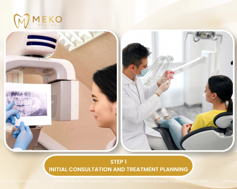 dental implants procedure