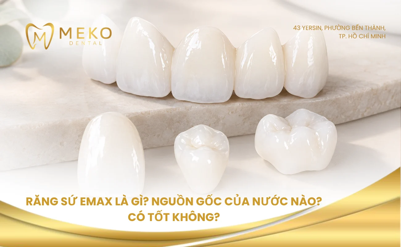 Răng sứ Emax là gì? Nguồn gốc của nước nào? Có tốt không?