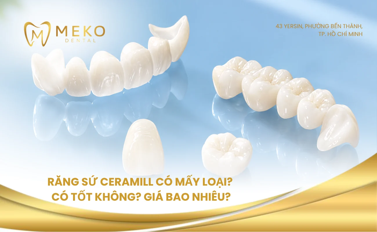Răng sứ Ceramill có mấy loại? Có tốt không? Giá bao nhiêu?