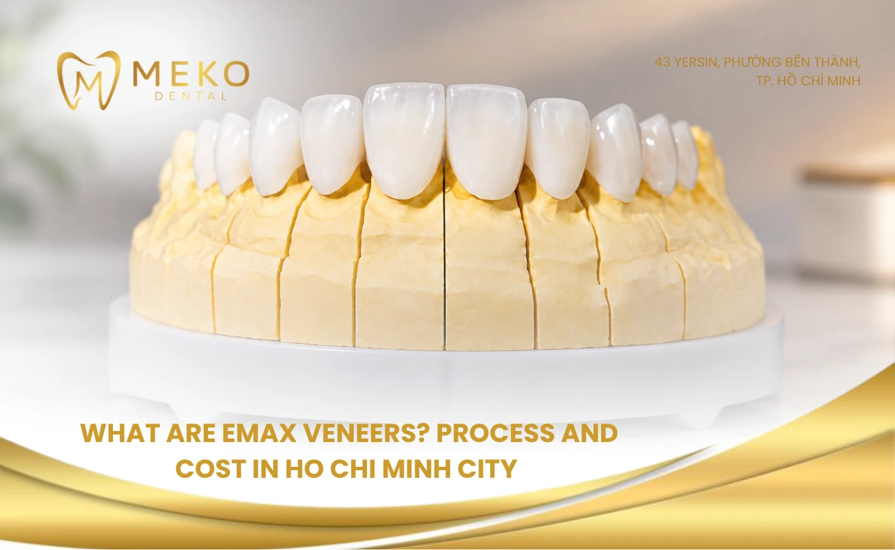 What are emax veneers? Process and cost in Ho Chi Minh City