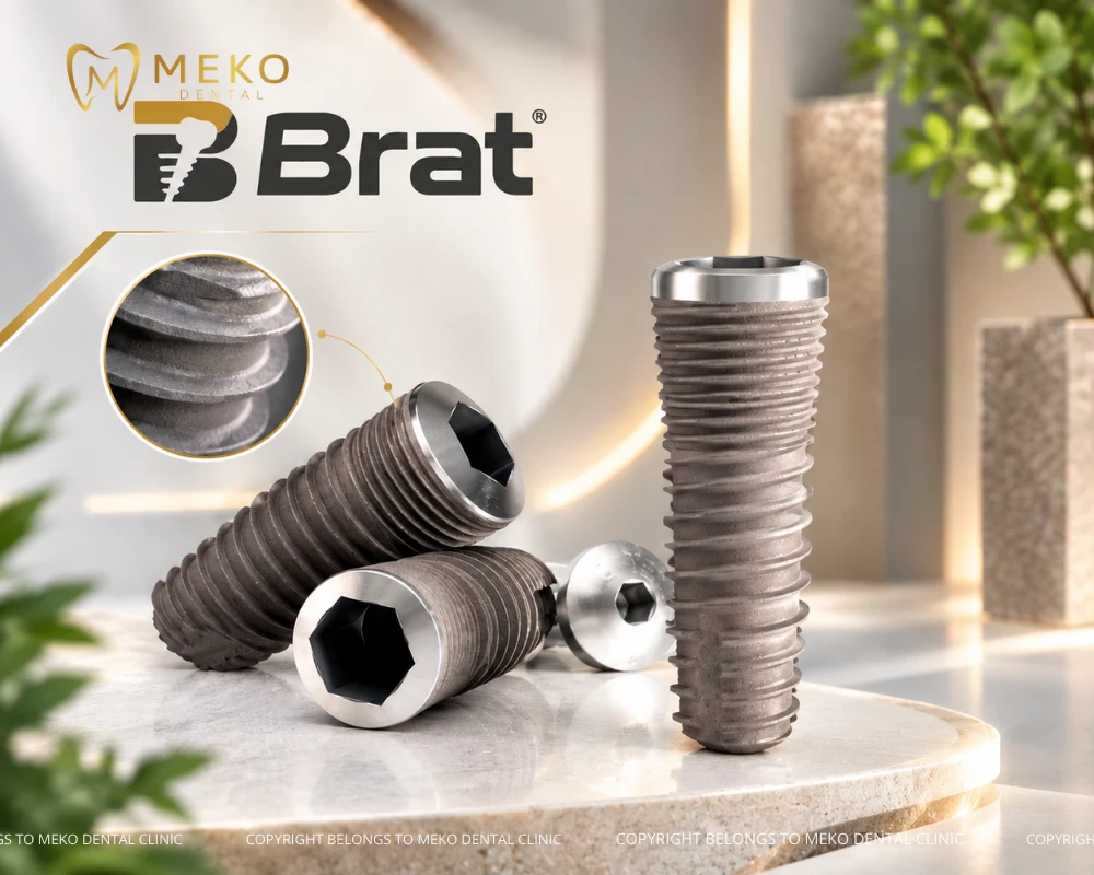 trồng răng implant pháp