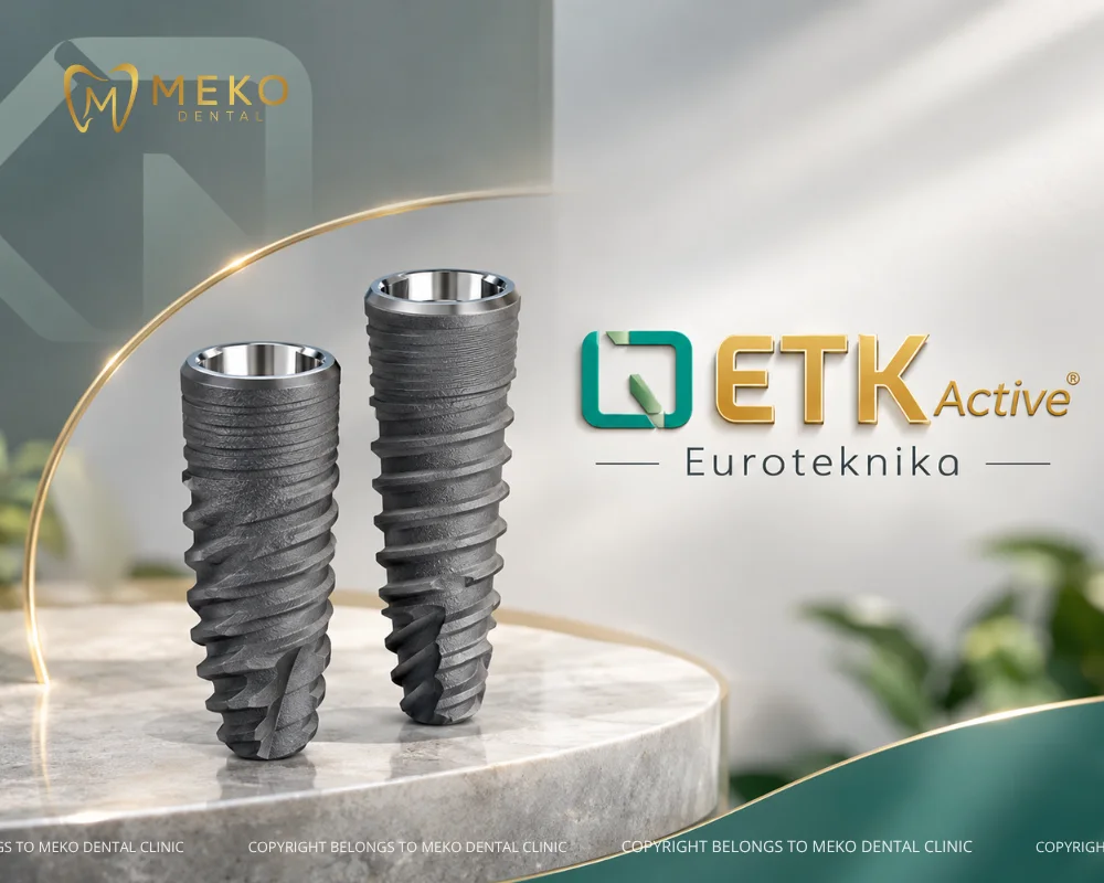 implant của pháp
