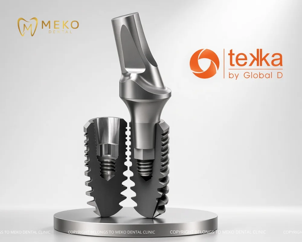 trụ implant pháp