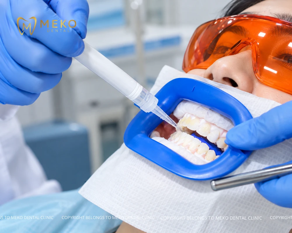 is zoom teeth whitening safe