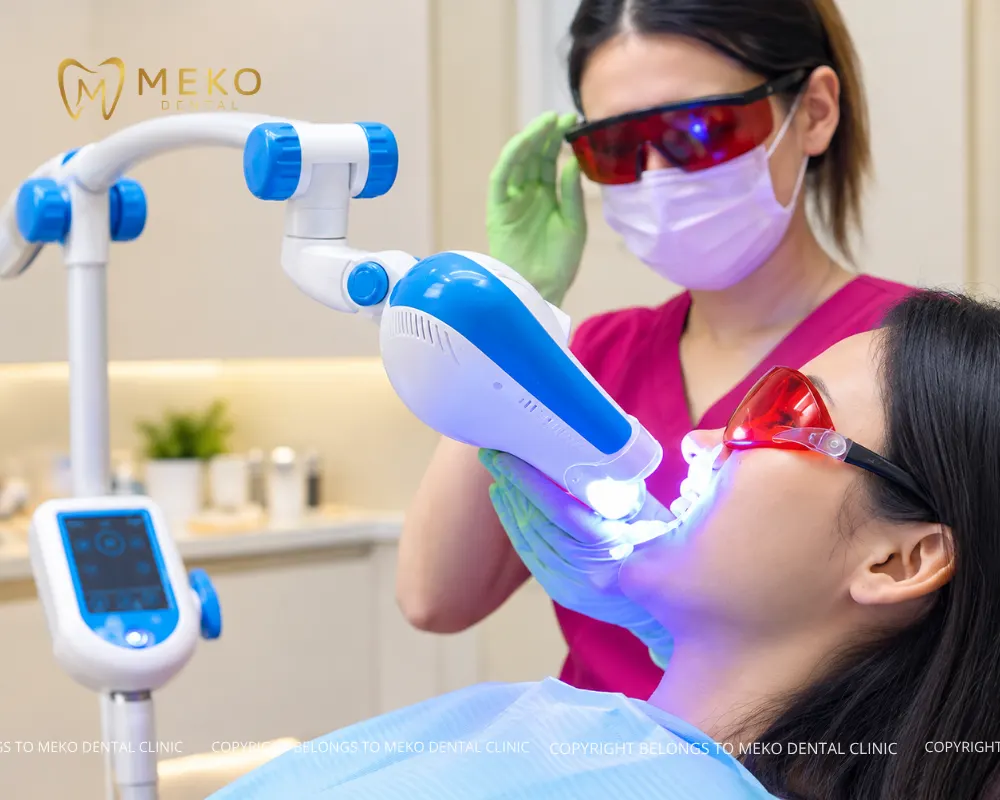 laser teeth whitening  
