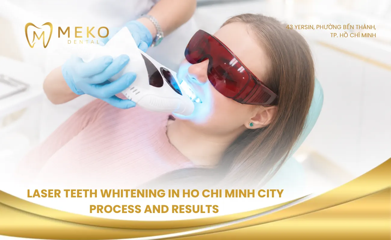 Laser teeth whitening in Ho Chi Minh city process and results 