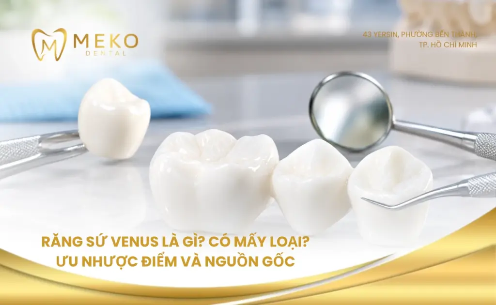 răng sứ venus có mấy loại