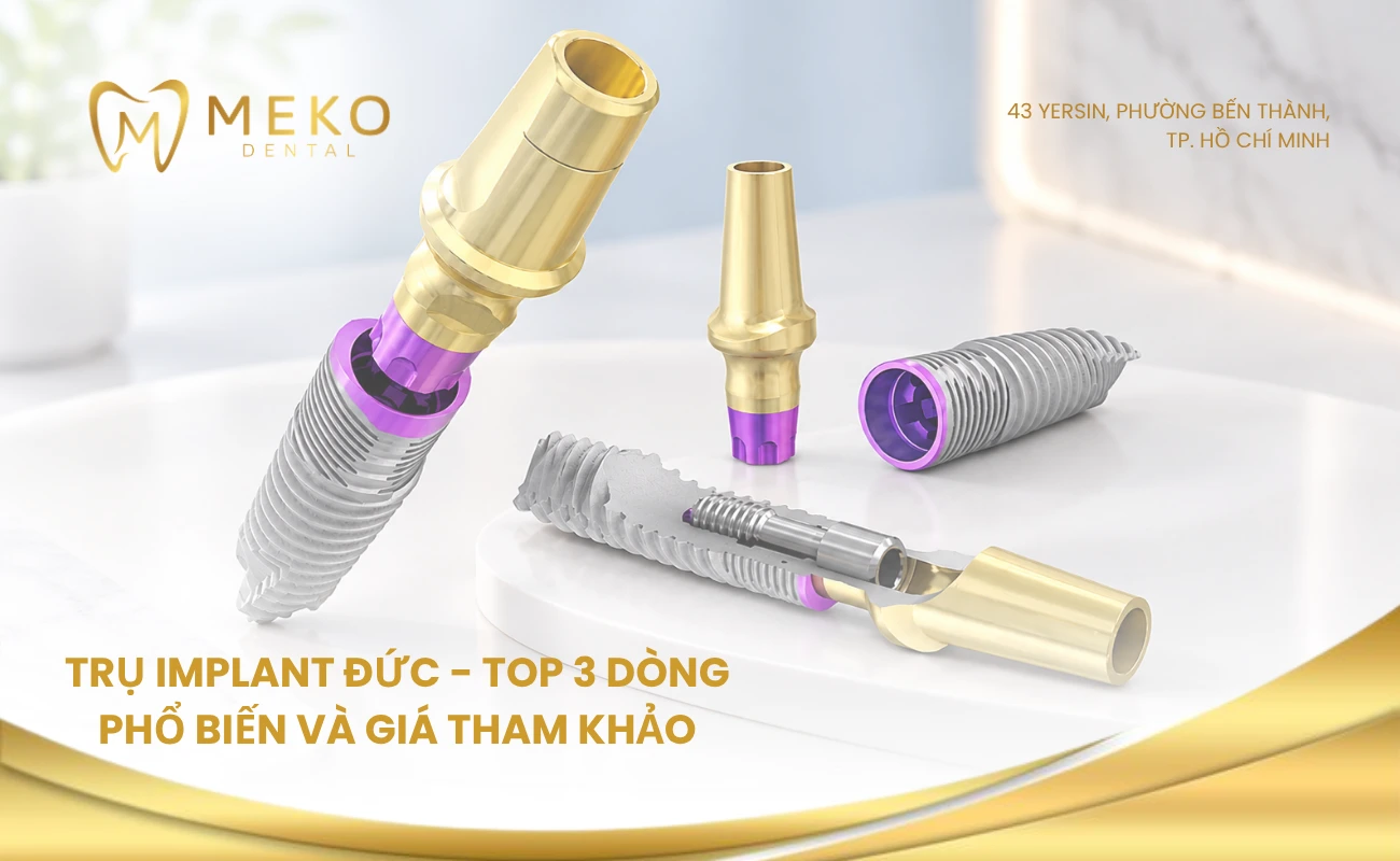 Trụ implant Đức: Top 3 dòng phổ biến và giá tham khảo 2026