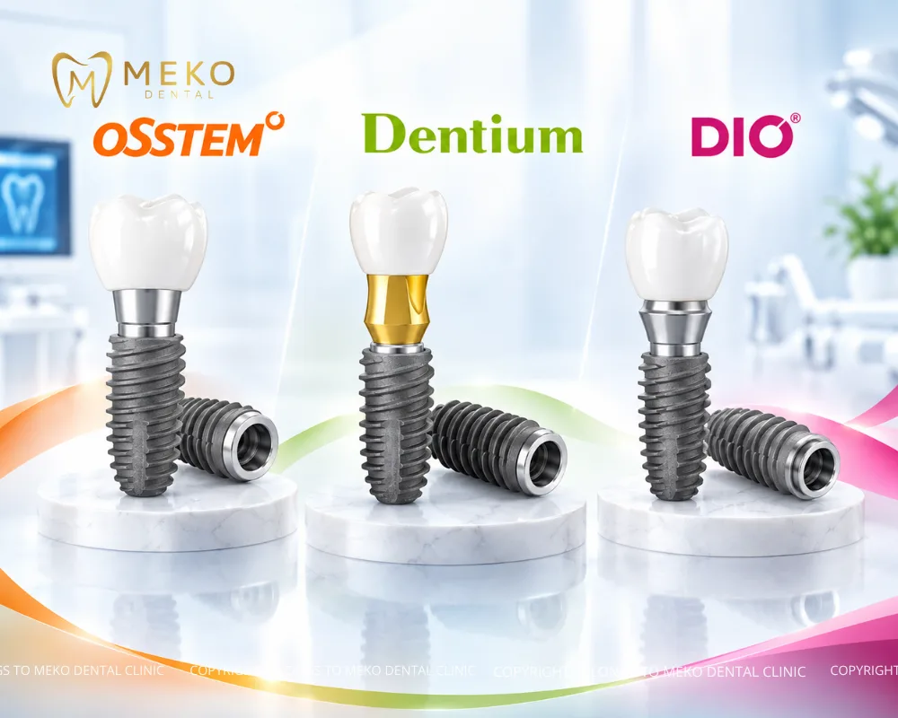 trụ răng implant hàn quốc