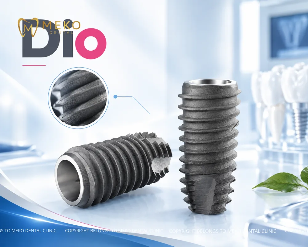 implant hàn quốc có mấy loại