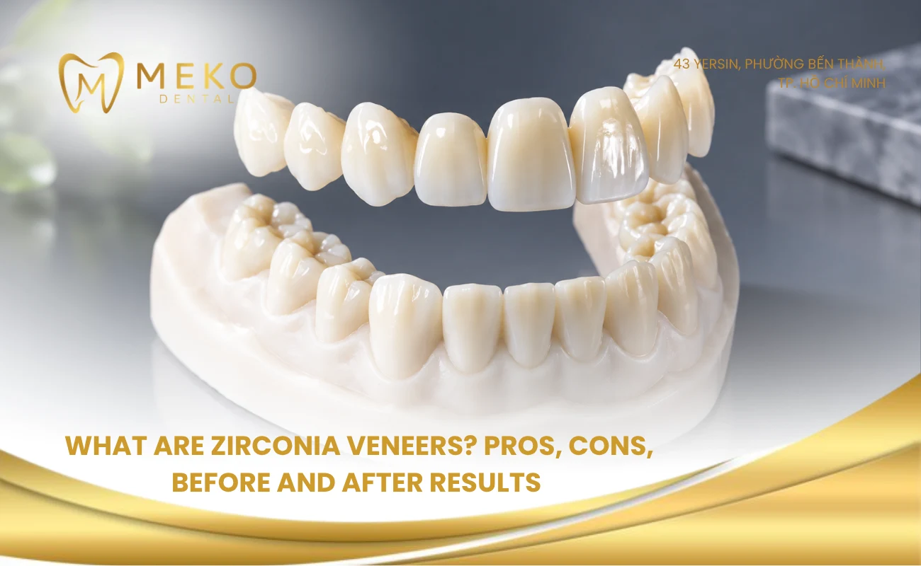 What are zirconia veneers? Pros, cons, before and after results