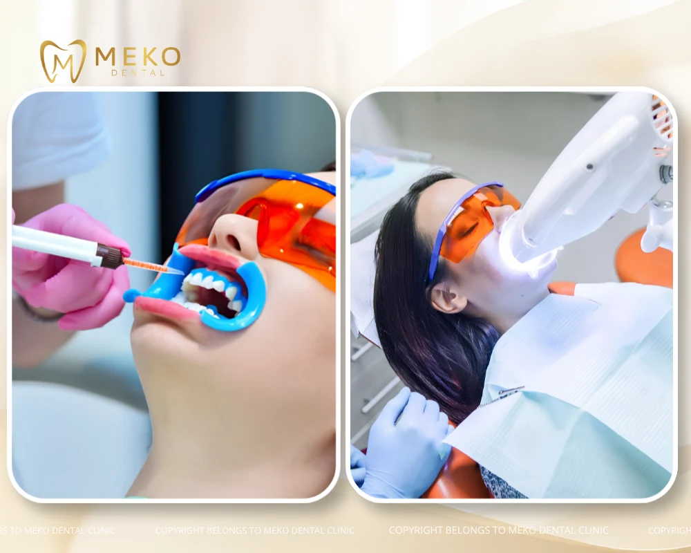 zoom whitening
